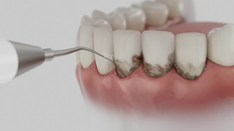 Reliable Tooth Extraction contractor in Mesquite, NV by Smile Center Dentistry